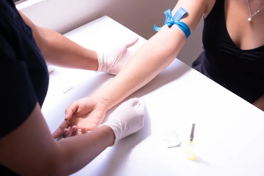 � realmente importante sempre fazer jejum antes do exame de sangue? Novo estudo com 100 mil pessoas diz que n�o; entenda